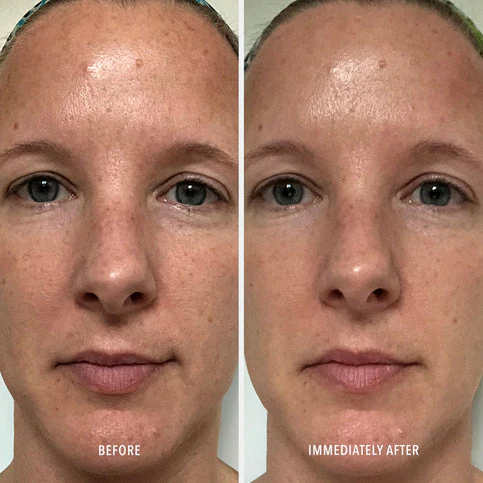 HydroPeptide | Polish & Plump Face Peel (2x 30ml) - Image 5