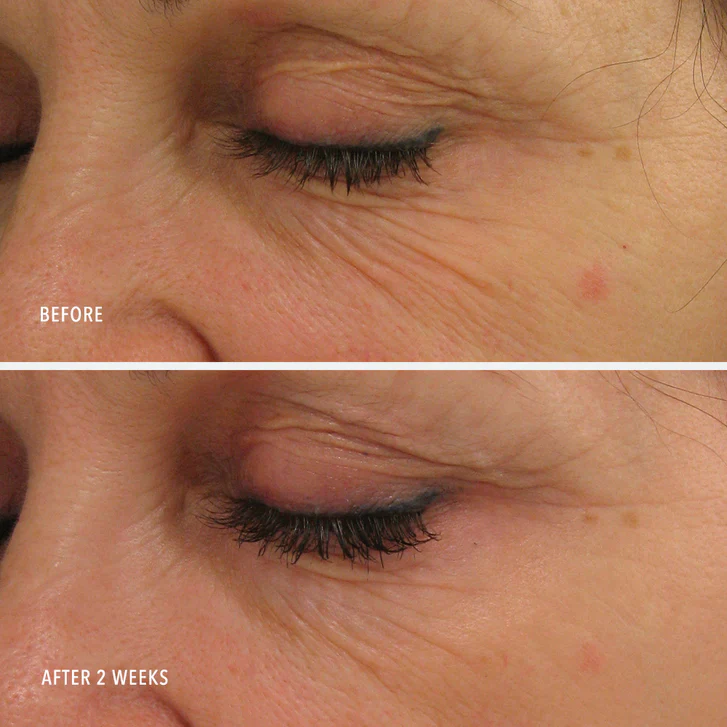 HydroPeptide | Power Lift : Advanced Ultra-Rich Moisturizer (30ml) - Image 6