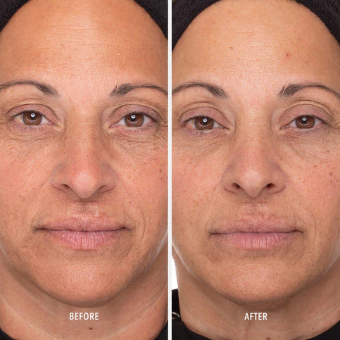 HydroPeptide | Retinol 1% Routine Booster (30ml) - Image 7