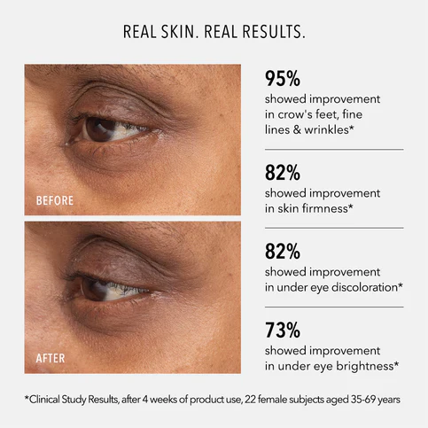 HydroPeptide | Retinol Eye Renewal Balm (15ml) - Image 4