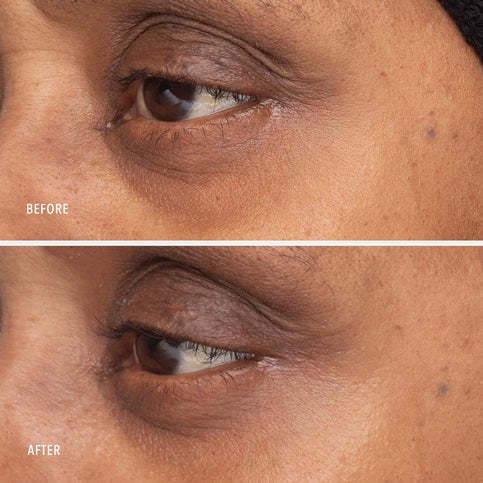 HydroPeptide | Retinol Eye Renewal Balm (15ml) - Image 5