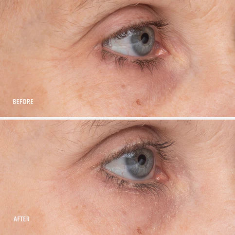 HydroPeptide | Retinol Eye Renewal Balm (15ml) - Image 6