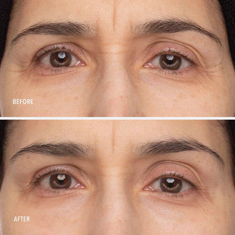 HydroPeptide | Retinol Eye Renewal Balm (15ml) - Image 7