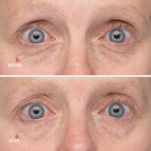 HydroPeptide | Retinol Eye Renewal Balm (15ml) - Image 8