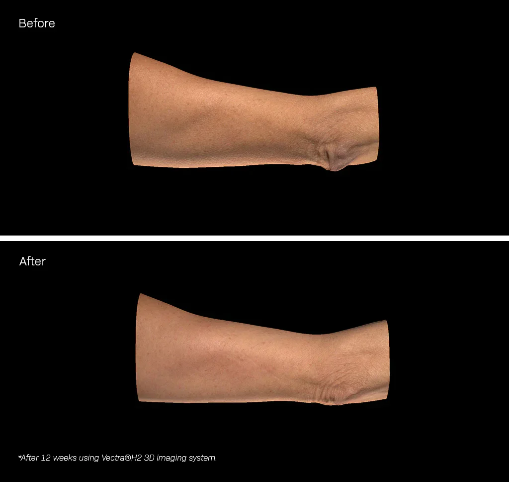 Revision Skincare | Bodifirm (107g) - Image 4