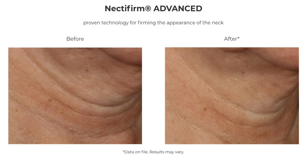 Revision Skincare | Nectifirm ADVANCED - Image 6