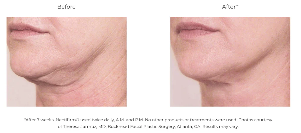 Revision Skincare | Nectifirm ADVANCED - Image 8