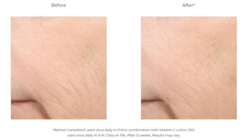 Revision Skincare | Retinol Complete 0.5 (30ml) - Image 4