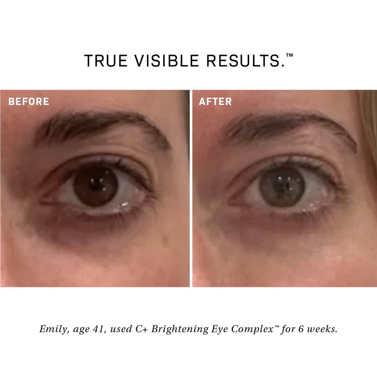 Revision Skincare | C + Brightening Eye Complex - Image 4