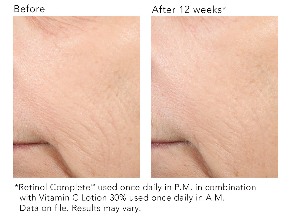 Revision Skincare | Vitamin C Lotion 30% (30ml) - Image 3