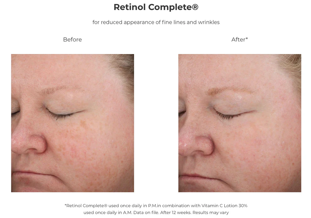 Revision Skincare | Vitamin C Lotion 30% (30ml) - Image 4