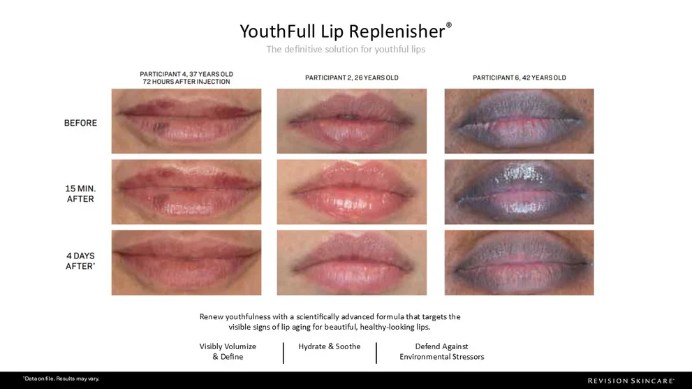 Revision Skincare | Youthful Lip Replenisher (9.4g) - Image 4