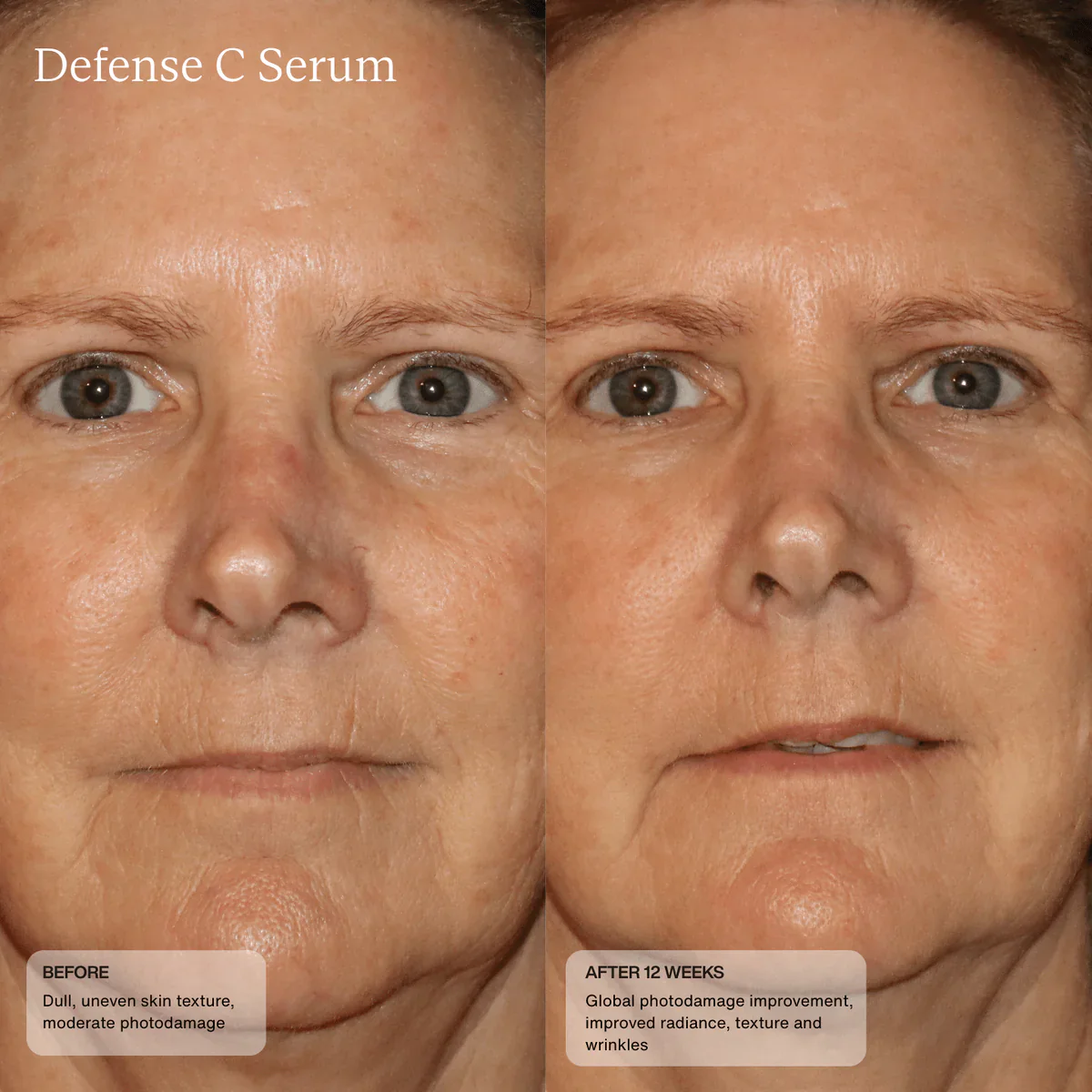 Senté | Defense C Serum (30ml) - Image 4