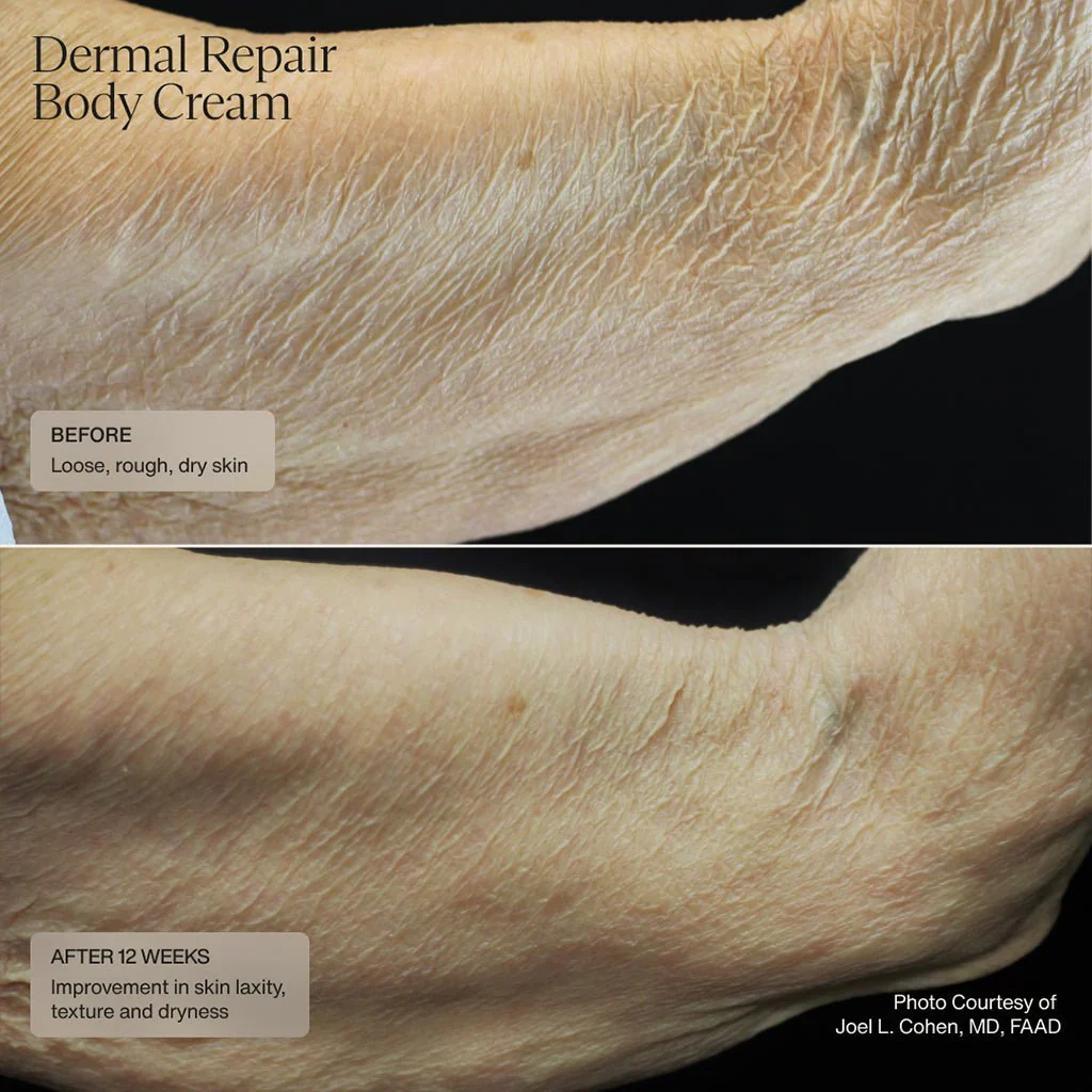 Senté | Dermal Repair Body Cream (177.4ml) - Image 4