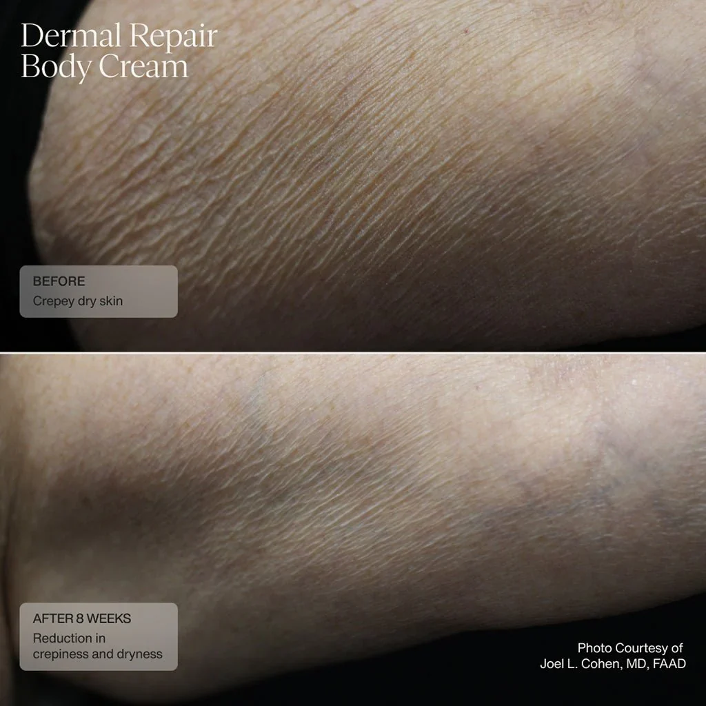 Senté | Dermal Repair Body Cream (177.4ml) - Image 5