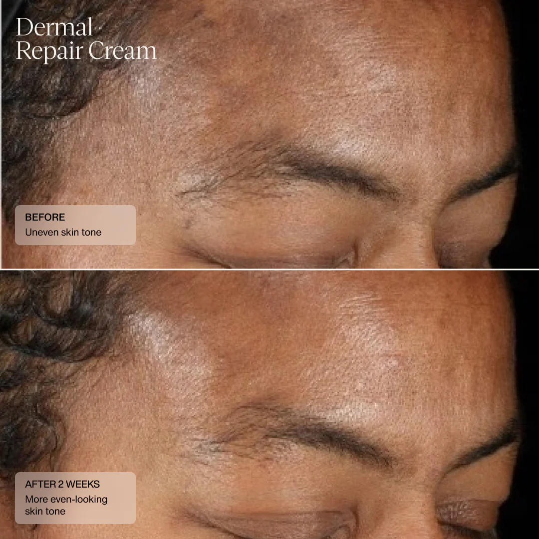 Senté | Dermal Repair Cream (50ml) - Image 4