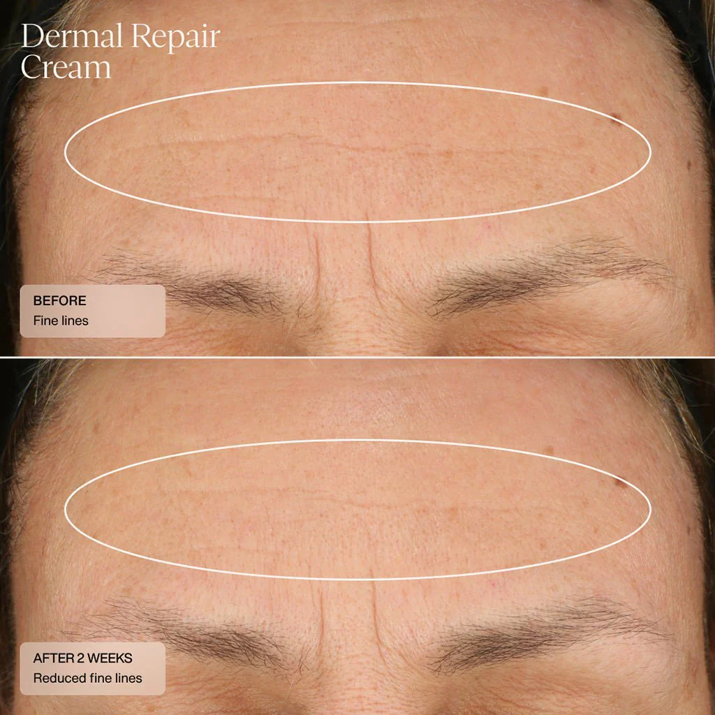 Senté | Dermal Repair Cream (50ml) - Image 6