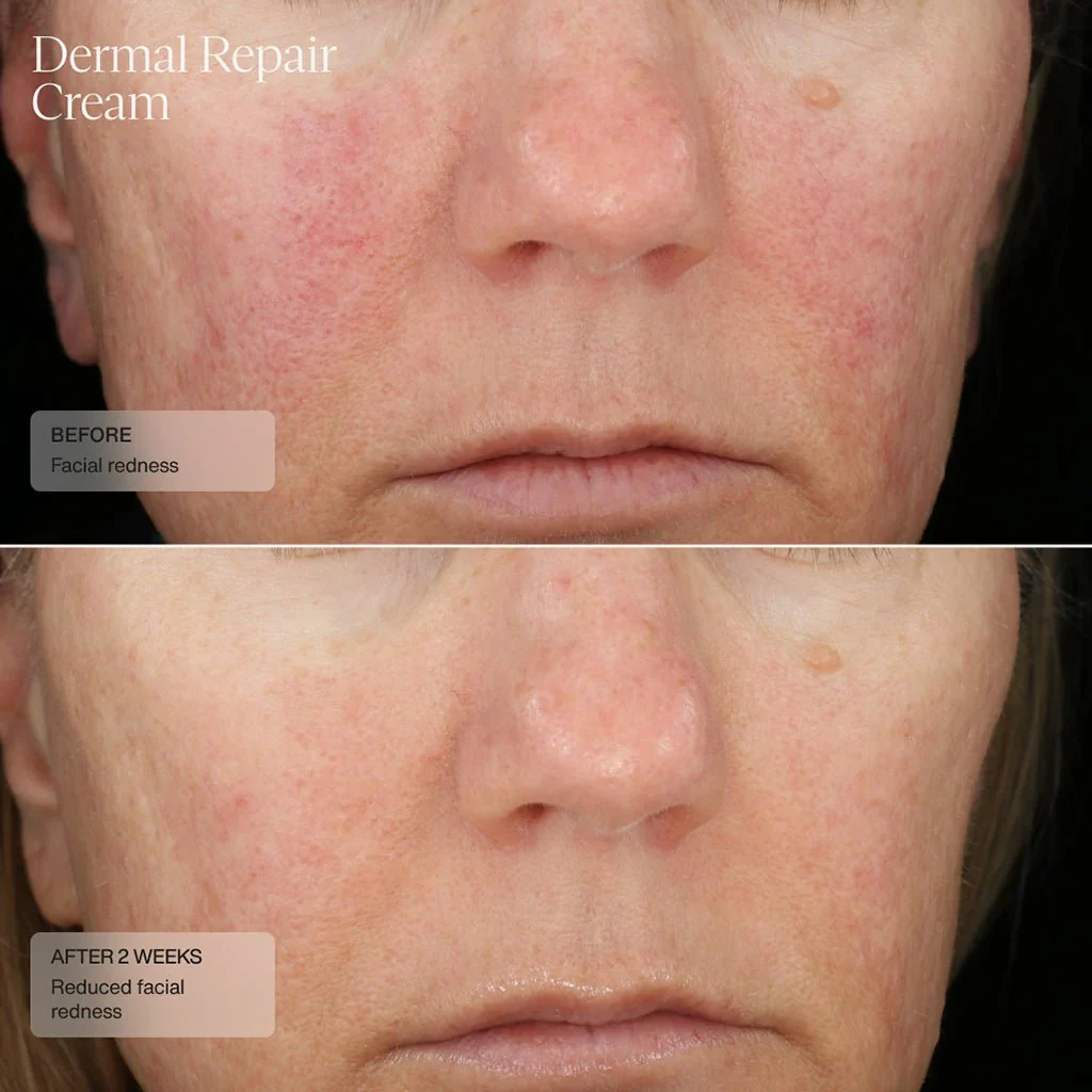 Senté | Dermal Repair Cream (50ml) - Image 8
