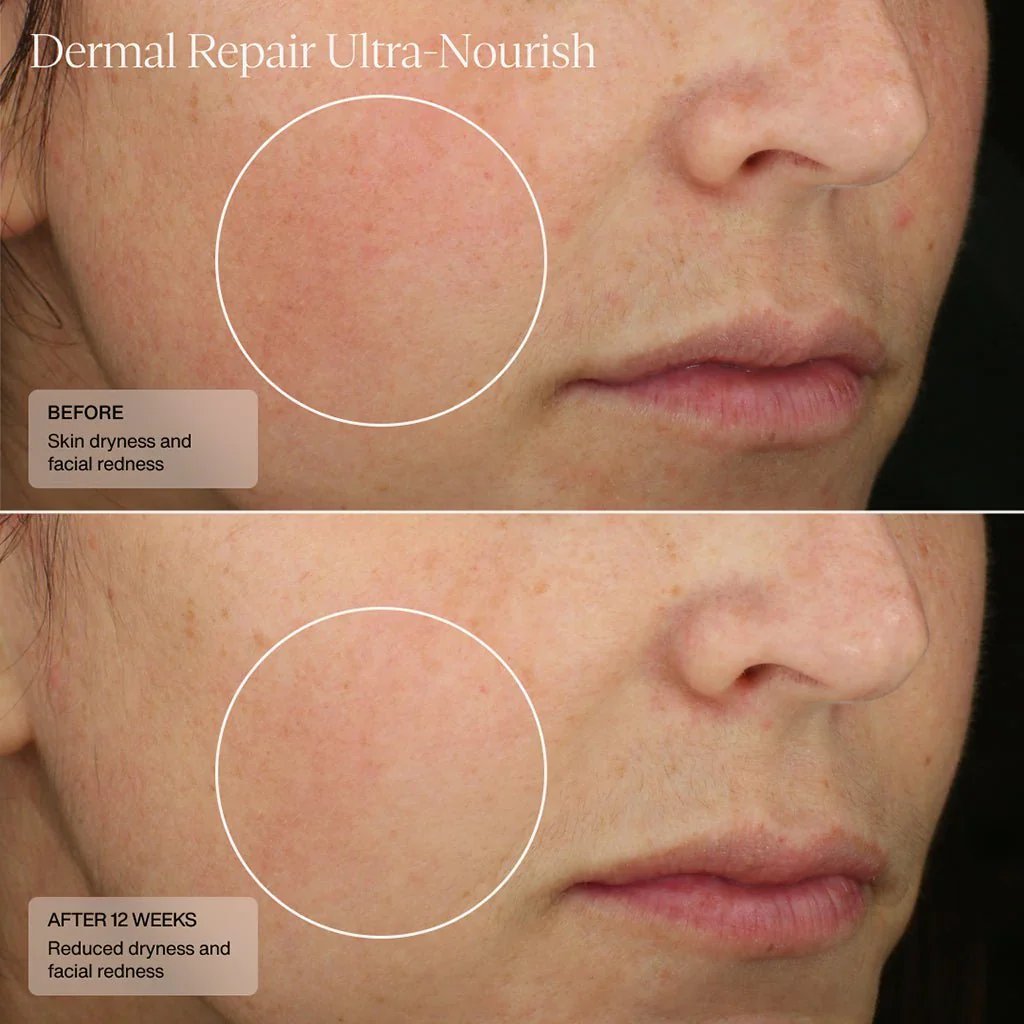 Senté | Dermal Repair Ultra-Nourish - Image 4