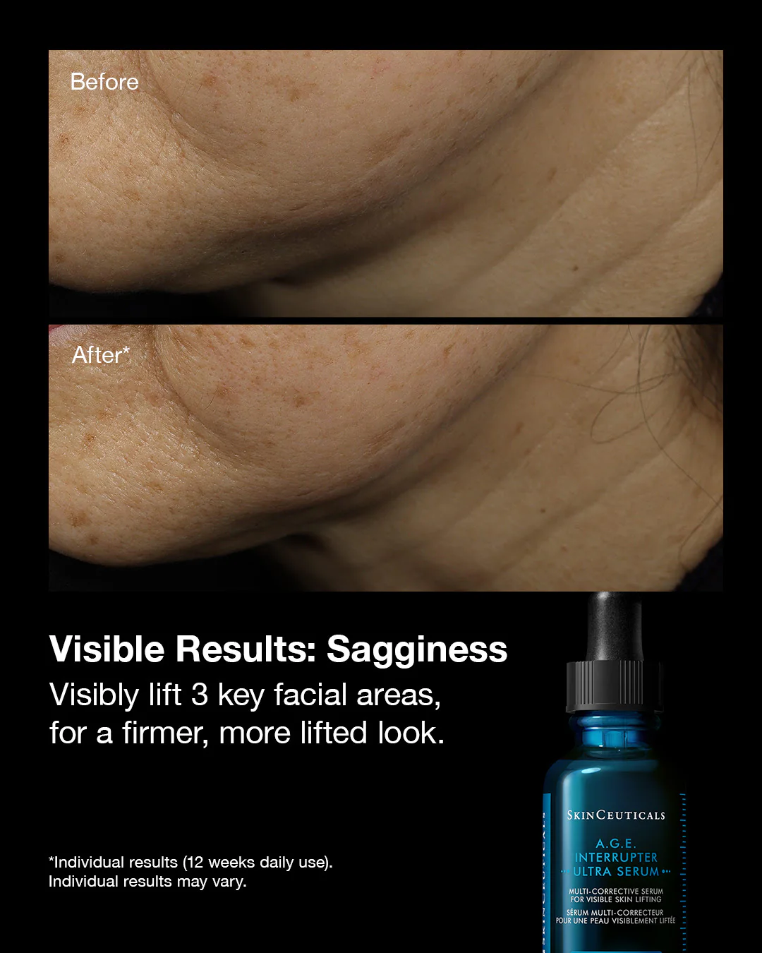 SkinCeuticals | A.G.E Interrupter Ultra Serum (30ml) - Image 3