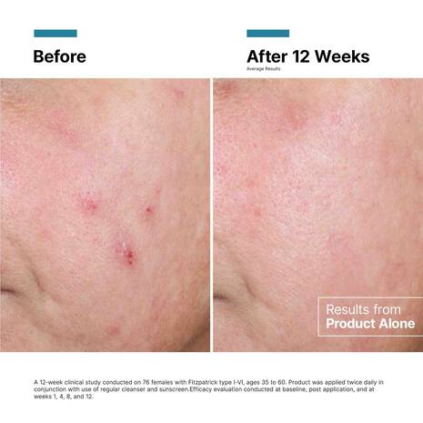 SkinCeuticals | Advanced RGN-6 Cream (50ml) - Image 8
