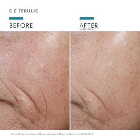 SkinCeuticals | C E Ferulic Double Defence Skincare Set - Image 4