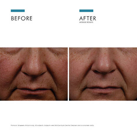 SkinCeuticals | Phloretin CF Double Defence Skincare Set - Image 4