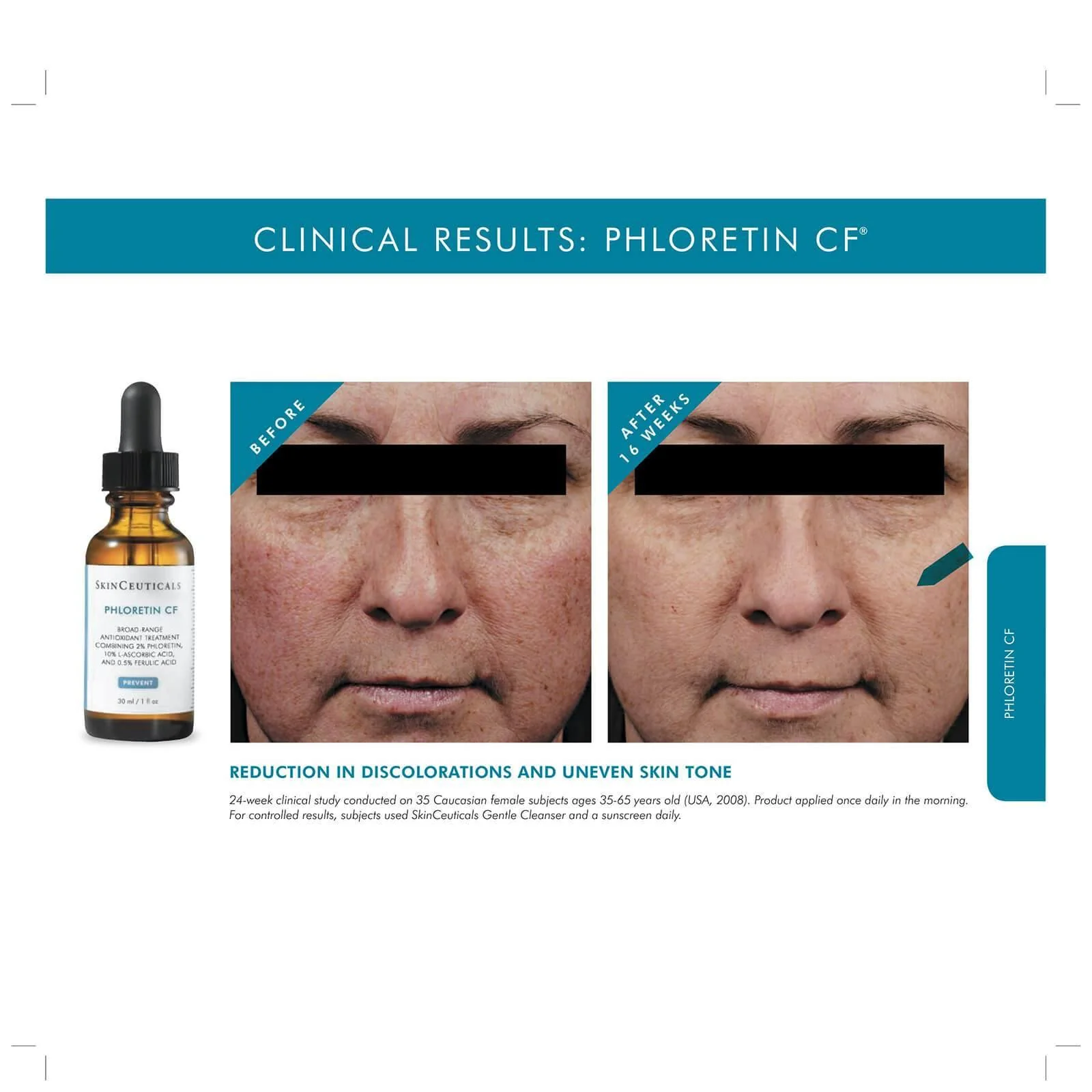 SkinCeuticals | Phloretin CF Serum (30ml) - Image 5