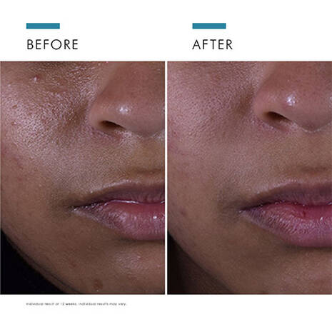SkinCeuticals | Silymarin CF Double Defence Skincare Set - Image 4