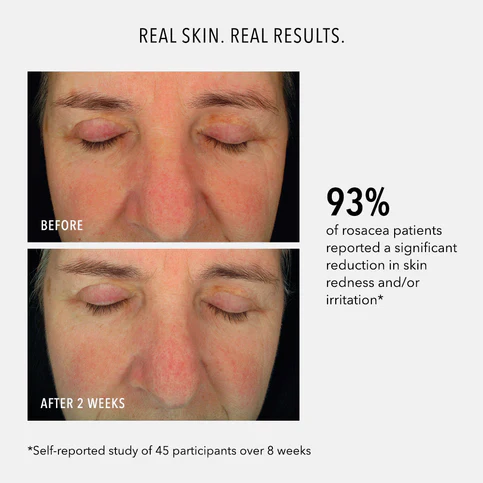 HydroPeptide | Soothing Serum : Redness Repair & Relief (30ml) - Image 4