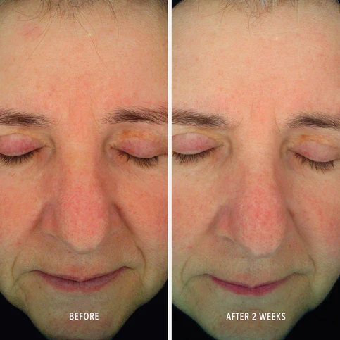 HydroPeptide | Soothing Serum : Redness Repair & Relief (30ml) - Image 5