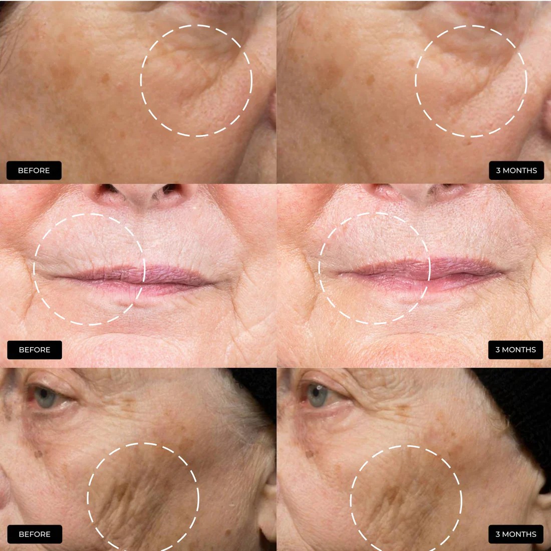 The Skin Diary | The Ultimate Skin Ageing Duo - Image 6
